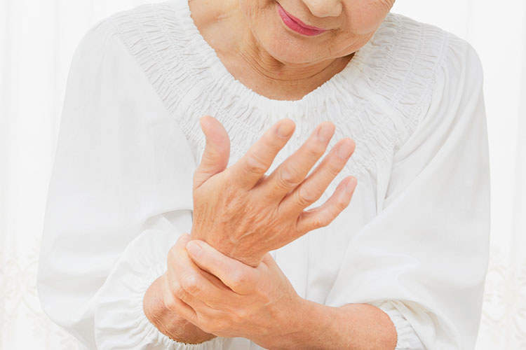 ドケルバン病イメージ