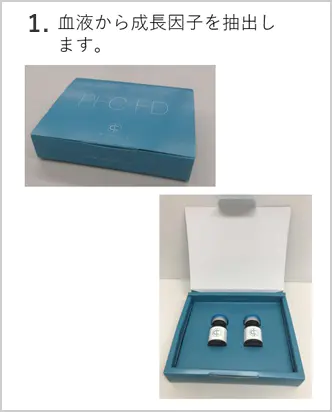 PFC-FD治療：血液から成長因子を抽出します