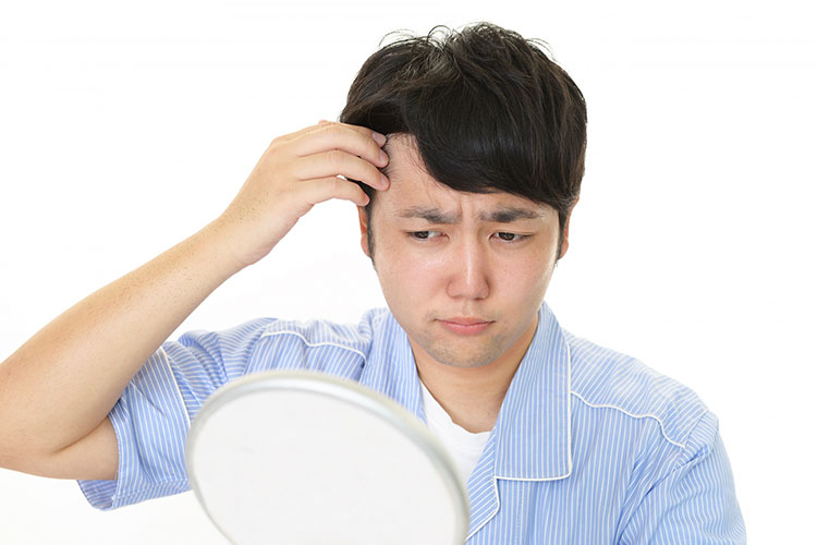 AGA（男性型脱毛症）の悩みイメージ
